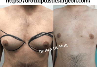 drattaplasticsurgeon